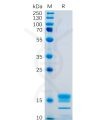 sp-pme100478 gitr ligand sp1