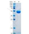 sp-pme100479 ctla 4 sp1