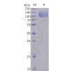 sp-pme100485 cd155 sp1