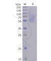 sp-pme100491 s1 protein ntd sp1
