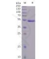 sp-pme100496 s1 protein ctd sp1
