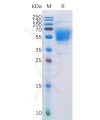 sp-pme100507 cb1 sp1