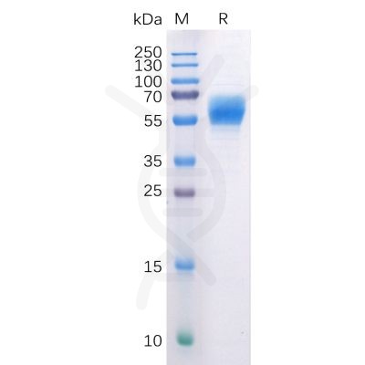 sp-pme100508 cb1 sp1