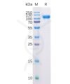 sp-pme100509 cd10 sp1