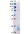 sp-pme100511 bcma sp1
