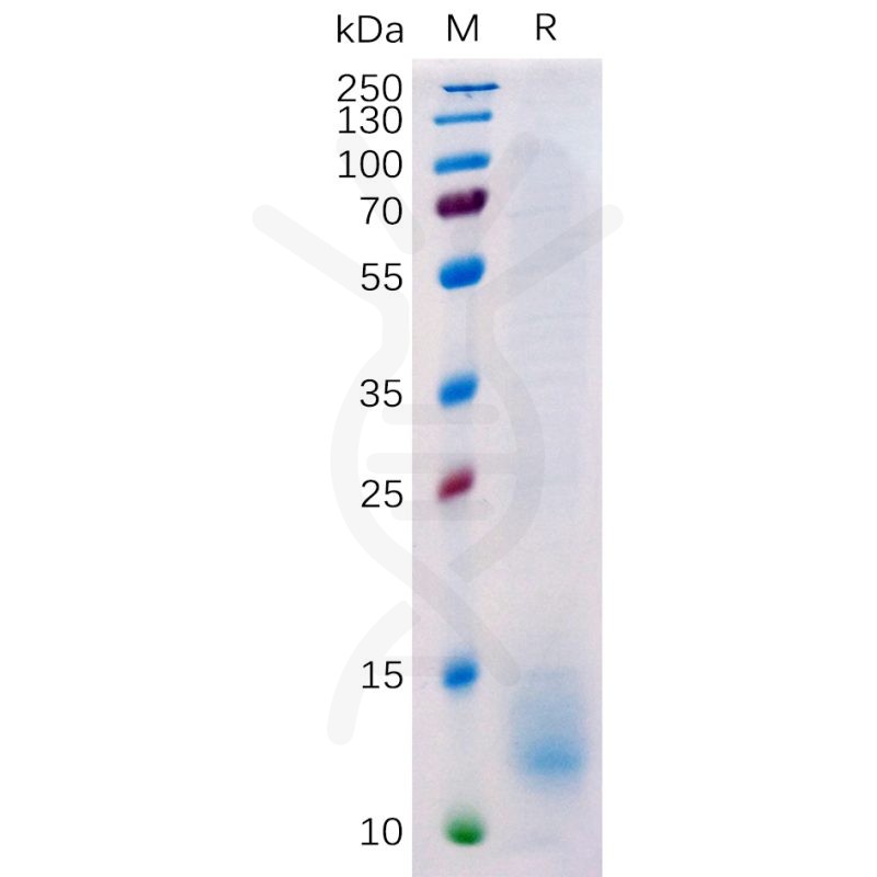 Buy Human BCMA Protein, His Tag-BCMA Recombinant Protein-DIMA BIOTECH