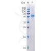 sp-pme100512 lag3 sp1