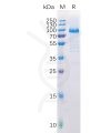 sp-pme100513 lag3 sp1