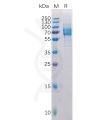 sp-pme100515 galectin 9 sp1