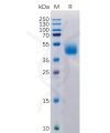 sp-pme100516 micb sp1