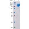 sp-pme100519 cd117 sp1
