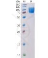 sp-pme100519 cd117 sp1