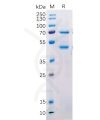 sp-pme100520 masp2 sp1