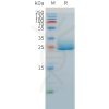 sp-pme100527 angptl3 sp1