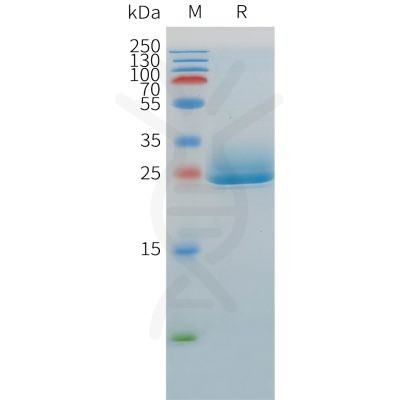 sp-pme100527 angptl3 sp1