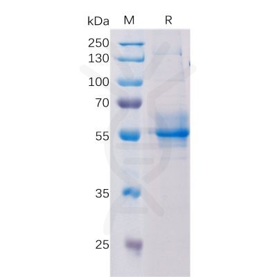 sp-pme100542 tmem173 sp1