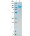 sp-pme100545 psma sp1