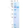 sp-pme100548 il15ra sp1