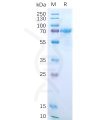 sp-pme100548 il15ra sp1