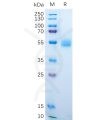 sp-pme100549 amhr2 sp1