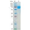 sp-pme100551 il4ra sp1