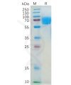 sp-pme100551 il4ra sp1