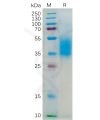 sp-pme100552 il4ra sp1