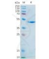 sp-pme100555 il21 sp1