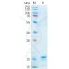 sp-pme100556 il21 sp1