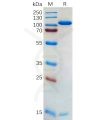 sp-pme100562 pcsk9 sp1