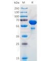 sp-pme100567 bcl2l1 sp1