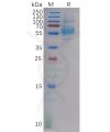 sp-pme100610 clec9a sp1