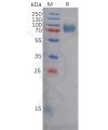 sp-pme100615 epha5 sp1