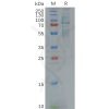 sp-pme100619 gas6 sp1