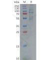 sp-pme100619 gas6 sp1