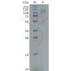 sp-pme100622 adgre1 sp1