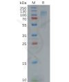 sp-pme100622 adgre1 sp1