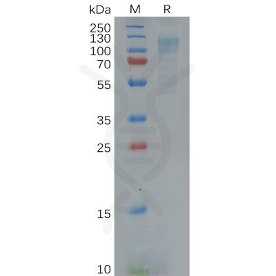 sp-pme100622 adgre1 sp1
