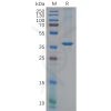 sp-pme100623 chi3l1 sp1