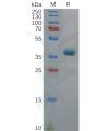 sp-pme100630 ror1 sp1
