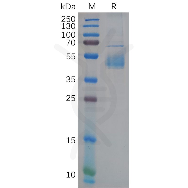 Buy Human GP1BB Protein, hFc Tag-GP1BB Recombinant Protein-DIMA BIOTECH