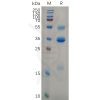 sp-pme100637 tslp sp1
