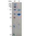 sp-pme100637 tslp sp1