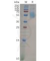 sp-pme100645 siglec7 sp1
