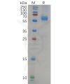 sp-pme100657 nucleocapsid sp1