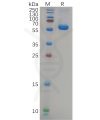 sp-pme100658 s protein rbd sp1