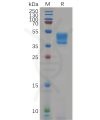 sp-pme100663 slc2a4 sp1