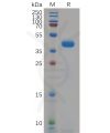 sp-pme100664 kcnk9 sp1