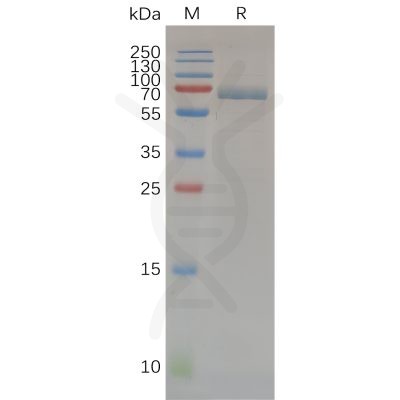 sp-pme100675 mmp14 sp1