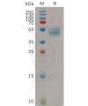 sp-pme100686 hbegf sp1